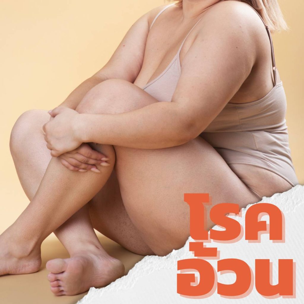 ลดความอ้วน, ลดน้ำหนัก, โรคอ้วน, ลดโรค